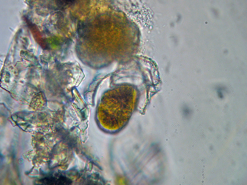 Dinoflagellato ?